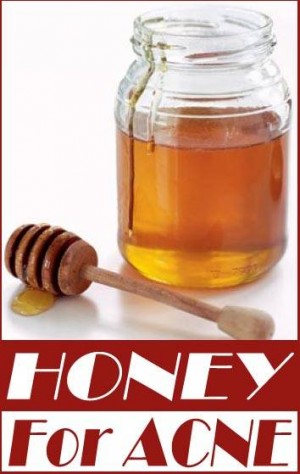 How To Use Natural Treatments Like Honey As A Cure For Acne